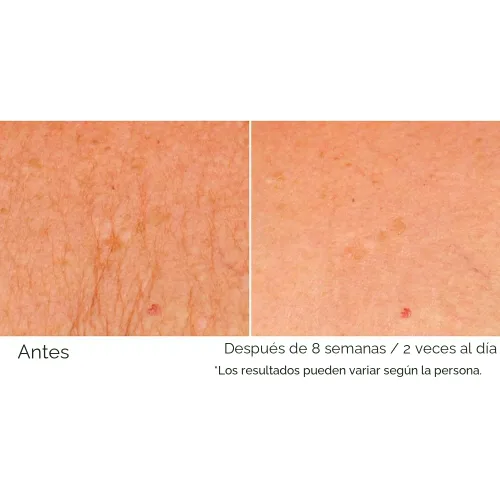 Vista 6 de NassifMD Deco-Lift Neck & Decollete Firming & Lifting Complex