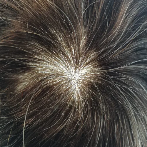 Vista 34 de Toupee para hombre 100% cabello humano real tupé para hombres 0.004 in piel de poliuretano para hombre, sistema de reemplazo de piezas de pelo
