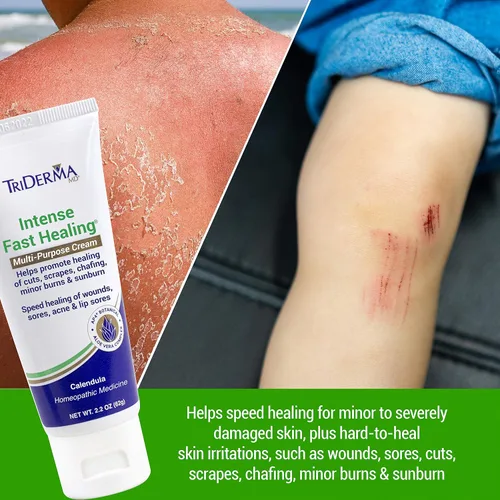 Vista 3 de TriDerma Crema multiusos intensa de curación rápida para cortes, rasguños, llagas, rozaduras, quemaduras menores y quemaduras solares