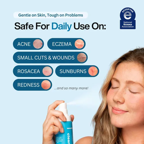 Vista 5 de Spray de ácido hipocloroso – Limpiador facial HOCl probado por dermatólogos para pieles sensibles, propensas al acné e irritadas – Alivia
