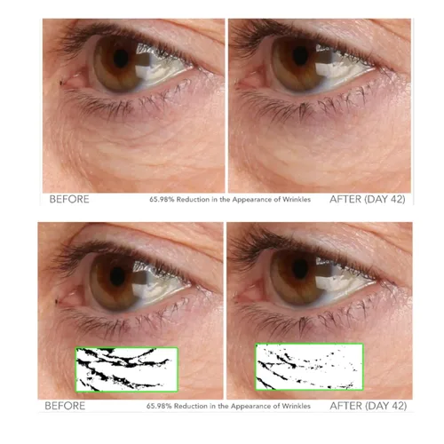 Vista 4 de Serious Skincare - Beyond - Suero intensivo de vitamina C para la cara - Tratamiento facial de 60 días para una piel sana y brillante e iluminadora
