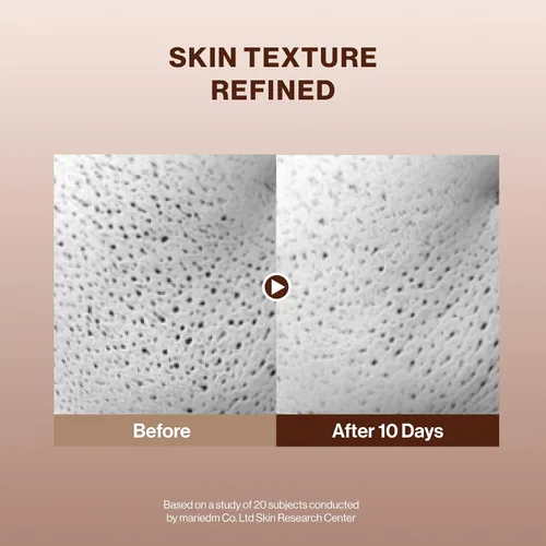Vista 4 de BEIGIC Treatment Essence - Esencia facial hidratante para una textura de piel radiante y suave con péptidos veganos y niacinamida para piel