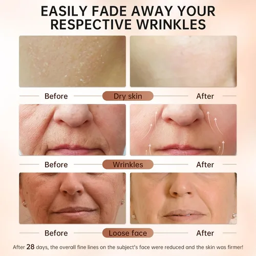 Vista 4 de VGO Suero de retinol para cara, suero de retinol rejuvenecedor con ácido hialurónico, niacinamida y ceramidas, hidratante y refrescante, suavizante