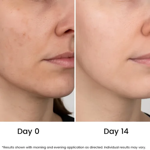 Vista 4 de All Natural Pure - Suero facial con 20% de vitamina C + 6 potenciadores activos para manchas oscuras, arrugas, iluminación, hidratación, tono