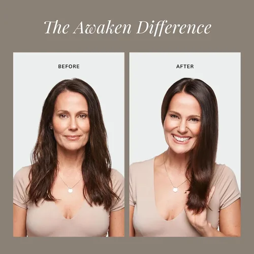 Vista 8 de Surface Acondicionador terapéutico Hair Awaken