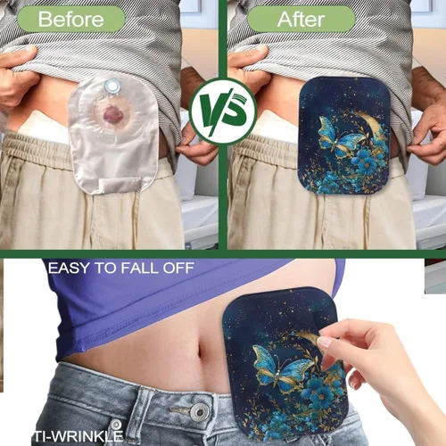 Vista 5 de Fundas para bolsas de ostomía, fundas para bolsas de colostomía para mujer, bolsas de suministros de ostomía