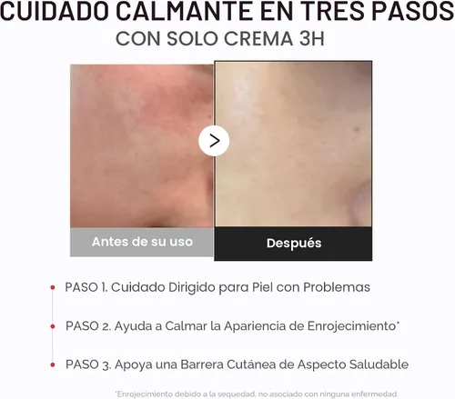 Vista 6 de medicube Almohadilla aclarante y crema calmante Duo: almohadilla de ácido succínico rojo y humectante diario 3H Exfoliación suave para una piel