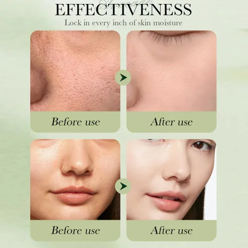 Vista 7 de Kit de cuidado de la piel de aguacate de 7 piezas, set de regalo para el cuidado de la piel con limpiador facial, tónico, loción, suero facial