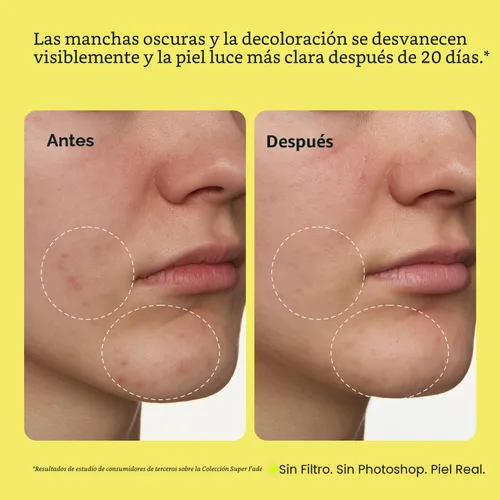 Vista 4 de Peach Slices - Suero de decoloración Super Fade para rostro (1.01 oz) - Manchas oscuras, hiperpigmentación, piel desigual - Suero de niacinamida