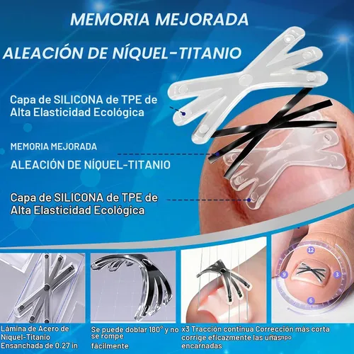 Vista 2 de Tratamiento de uñas encarnadas con forma mejorada de 6 ángulos, corrector de uñas encarnadas de aleación de titanio para un alivio rápido, kit
