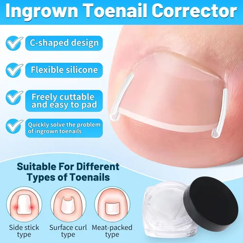 Vista 3 de SelfTek Kit de uñas encarnadas – Kit profesional de corrector de uñas encarnadas con tiras transpirables y parches curvos, lima sin dolor