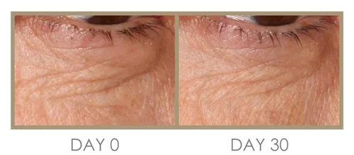 Vista 4 de Genie H 'Eye 'drator Eye Crema