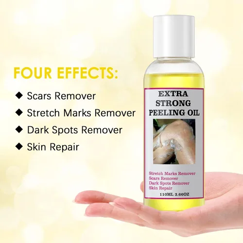 Vista 7 de Aceite de pelado para piel oscura, aceite de pelado amarillo, aceite de pelado fuerte, solución exfoliante de pelado extra fuerte para máscara
