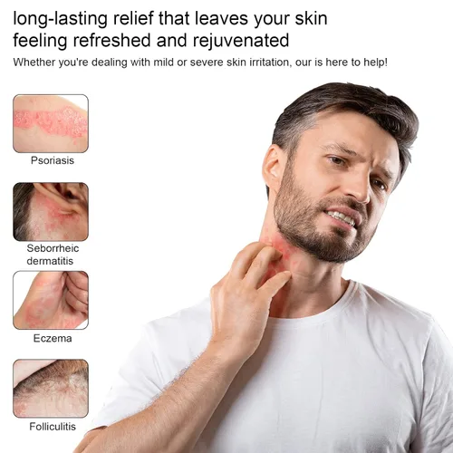 Vista 7 de Crema orgánica de loción de miel de manuka con avena coloidal, hidratante calmante para piel seca, para alivio, eccema de manos y cuerpo, psoriasis