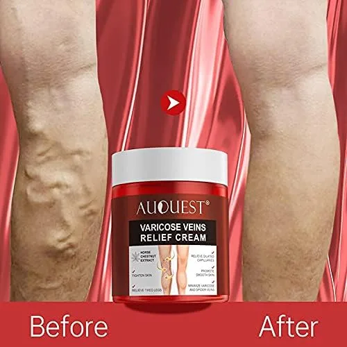 Vista 2 de AUQUEST 2.82 oz Pies Varices Crema Tratamiento Aliviar Capilares Dilatados Eliminación Flebitis Araña Pierna Venas Varices Crema