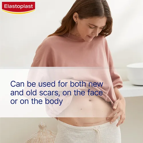 Vista 7 de Elastoplast Yesos reductores de cicatrices (21 piezas), tratamiento rápido y cómodo para cubrir cicatrices, hojas de cicatrices para reducir
