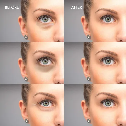 Vista 5 de Mascarilla de tratamiento de ojos de aloe vera (30 pares) reduce la hinchazón, las arrugas, la hinchazón y las bolsas debajo de los ojos, aclara