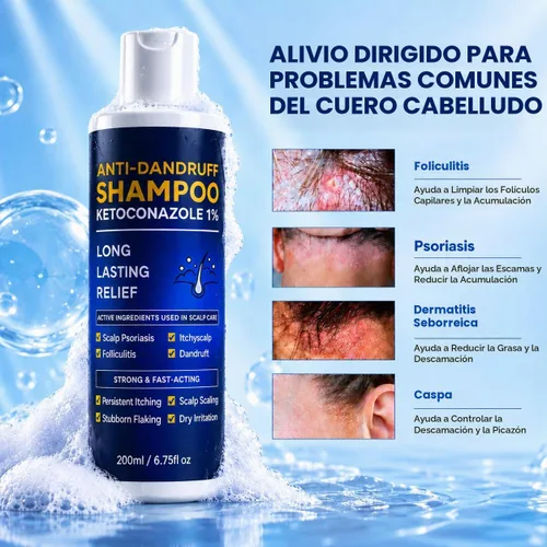 Vista 3 de Ketoconazole 1% Champú anticaspa Picazón Cuero cabelludo Flake Control 6.8 Champú anticaspa Cuidado del cuero cabelludo Ayuda a controlar