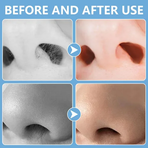 Vista 7 de Cortador de pelo nasal 2 en 1, recortador manual de doble cara con cepillo, cuchillo de nariz giratorio de 360° para hombres y mujeres, herramienta