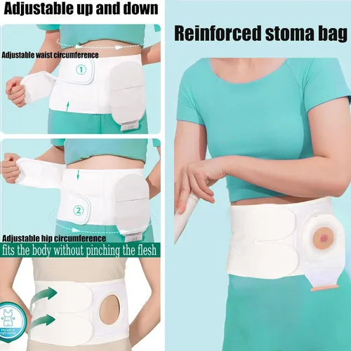 Vista 2 de Cinturón de soporte para ostomía, ajustable para prevenir hernia parastomal para hombres y mujeres Cinturón de soporte abdominal postoperatorio
