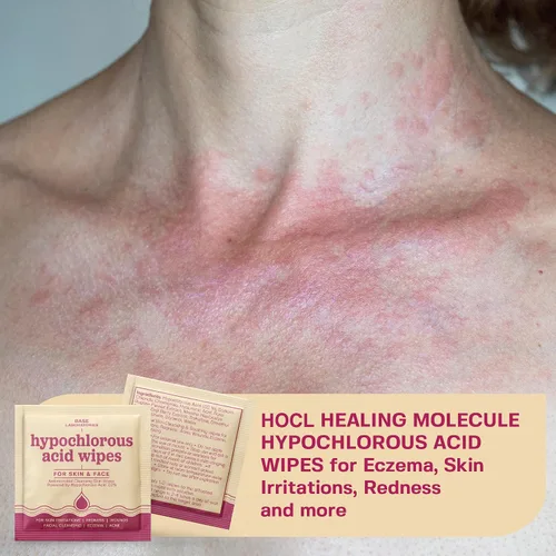 Vista 3 de BASE LABORATORIES Toallitas de ácido hipocloroso para rostro y piel – Limpieza facial y reparación diaria de la piel Toallitas de ácido hipocloroso
