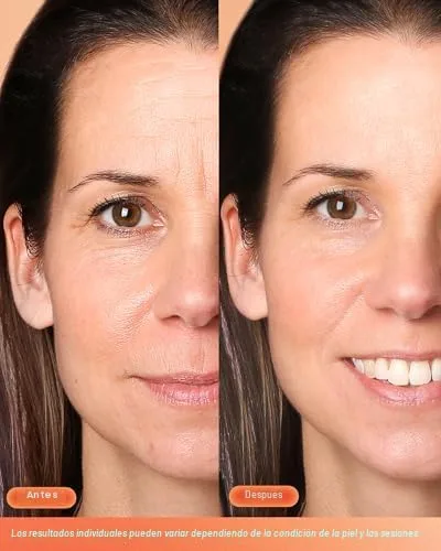 Vista 2 de NEWKEY Máscara de terapia de luz roja para cara, 7 colores LED máscara facial terapia de luz, fotón en casa cuidado de la piel máscara de belleza