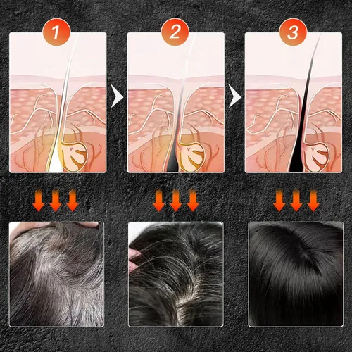 Vista 4 de TPTAL Barra inversa de cabello gris, jabón negro para cobertura de cabello gris, barra de champú para oscurecer el cabello natural, champú