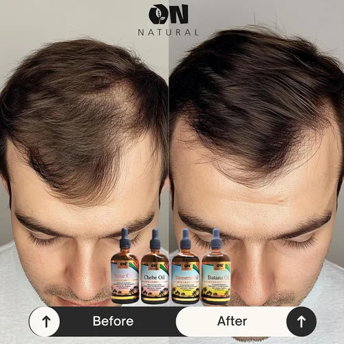 Vista 9 de On Natural Aceite de batana para mejorar el cabello y el cuero cabelludo