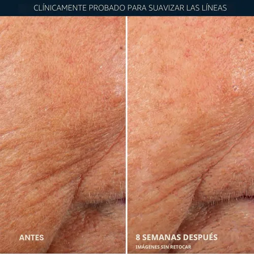 Vista 5 de RoC Retinol Correxion Suero de Noche Anti-Envejecimiento contra Arrugas, Suero de Retinol para el Rostro, Tratamiento Diario para Líneas Finas