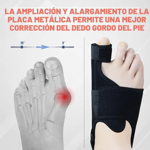 Vista 4 de MOONSMILE 1 par de correctores de juanetes de pies para mujeres y hombres, férula nocturna para juanetes, enderezador de dedo gordo para el pie