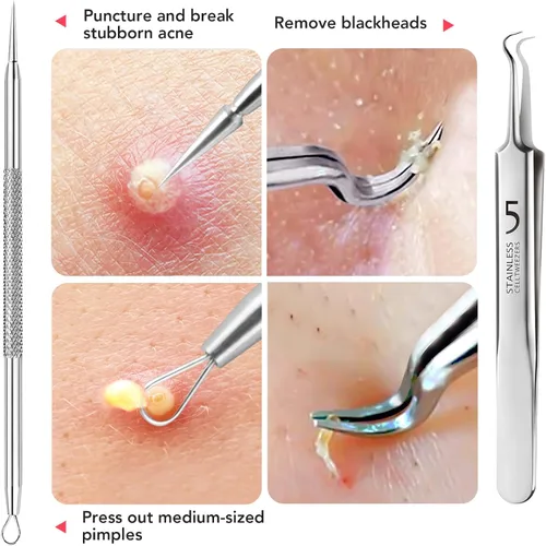 Vista 5 de Litbear - Juego de herramientas para eliminar puntos negros, 6 unidades Blackhead Pimple Comedones Extractor, Acne Tools Extractor kit, Scraper