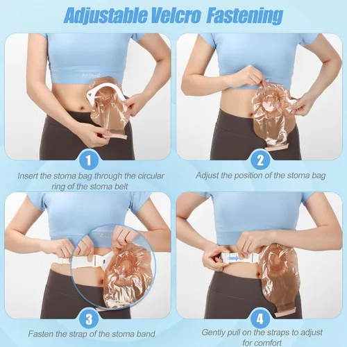 Vista 6 de Cinturón ajustable para mujer y hombre, impermeable, cinturón de colostomía Stealth Hernia Belt for Colostomy/Ileostomy Medical Stoma Support Belt