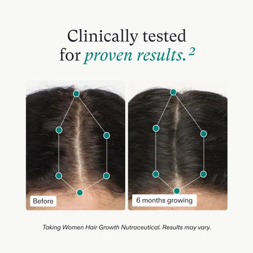 Vista 4 de Nutrafol Suplementos para el crecimiento del cabello y suero capilar para mujeres, de 18 a 44 años, clínicamente probado para grosor y fuerza