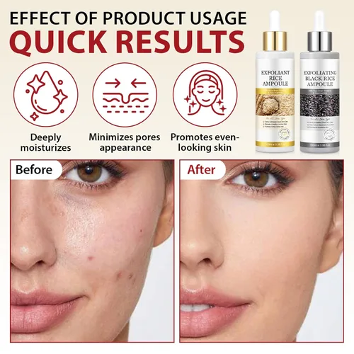 Vista 3 de Paquete de 2 ampollas de arroz Peel Shot Glow Dúo, exfoliante de arroz blanco y negro para todo tipo de piel, minimizador hidratante de poros