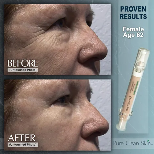 Vista 4 de EUZEN - Crema para apretar la piel para la cara – Obtén un estiramiento facial instantáneo en 3 a 5 minutos – esta crema antiarrugas para ojos