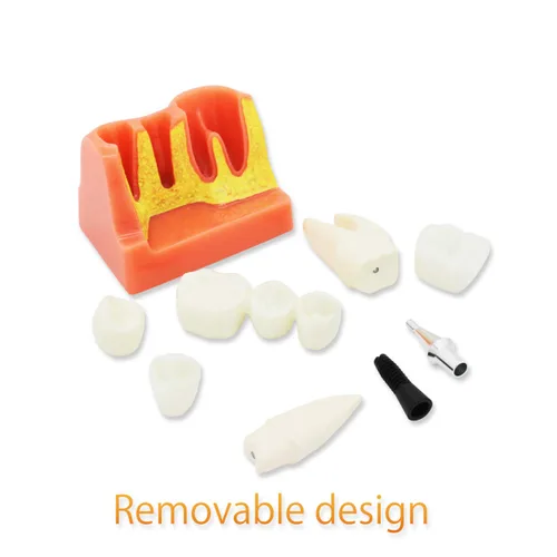 Vista 7 de Modelo de dientes dentales D-IP, modelo de dientes de implante dental transparente Dentista Enfermedad estándar Diente extraíble Modelo de enseñanza