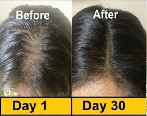 Vista 4 de Evion 400 mg vitamina E cápsula para cara, cabello, espinillas, piel brillante, ojeras, blanqueamiento de la piel y control de la pérdida de cabello