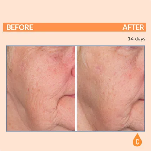 Vista 2 de Serious Skincare Suero de vitamina C para cara, suero facial antienvejecimiento con colágeno, vitamina E, cuidado hidratante de la piel
