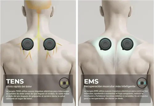 Vista 7 de Chirp Halo - Estimulador muscular inalámbrico - Dispositivo EMS portátil para recuperación muscular, alivio del dolor y entrenamiento de fuerza