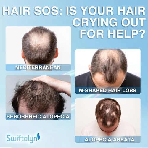 Vista 3 de Suero natural para el crecimiento del cabello para hombres: aceite para el cabello y el cuero cabelludo con romero, aceite de batana, agua de arroz