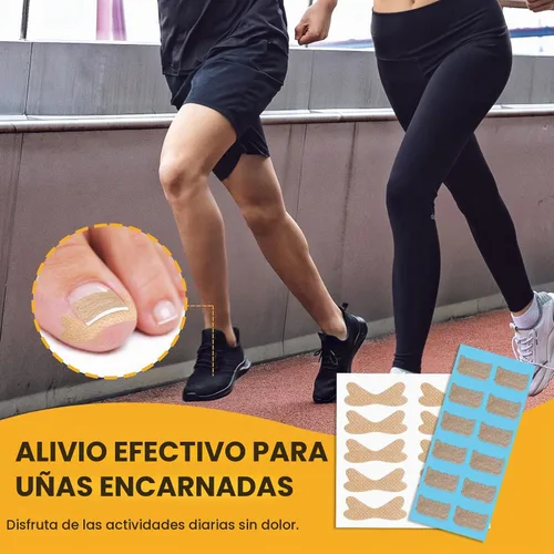 Vista 2 de BEZOX 60 parches correctores de uñas encarnadas transpirables y 50 calcomanías para uñas encarnadas – Cinta de uñas encarnadas