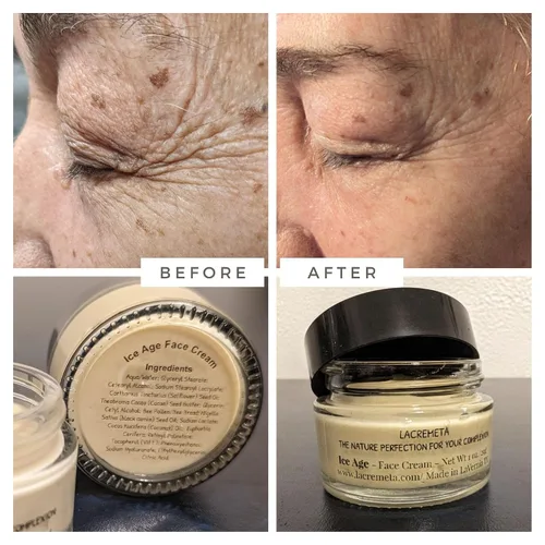 Vista 3 de Ice Age - Crema facial antienvejecimiento para hombres y mujeres con aceite de semilla negra, polen de abeja/pan de abeja, retinol, ácido