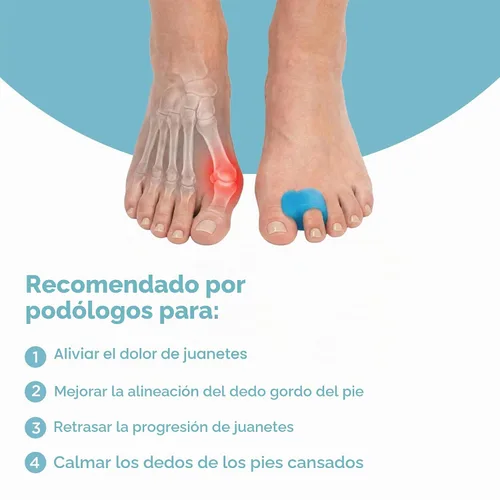 Vista 3 de Mind Bodhi - Separadores de dedos de un solo bucle, paquete de 4: corrigen juanetes y restauran los dedos de los pies a su forma original, para Azul