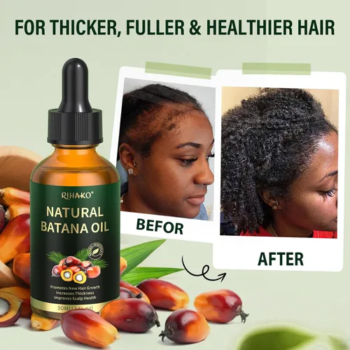 Vista 5 de RIHAKO Regalos de Pascua para mujeres – Suero para el crecimiento del cabello, aceite de batana para el crecimiento del cabello, 100% puro