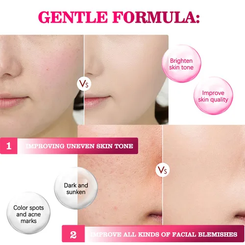 Vista 6 de DIMOT Arbutin 7% Crema facial ácida, 70,000 ppm de arbutina para el cuidado de la piel brillante, crema facial hidratante juvenil para todo tipo