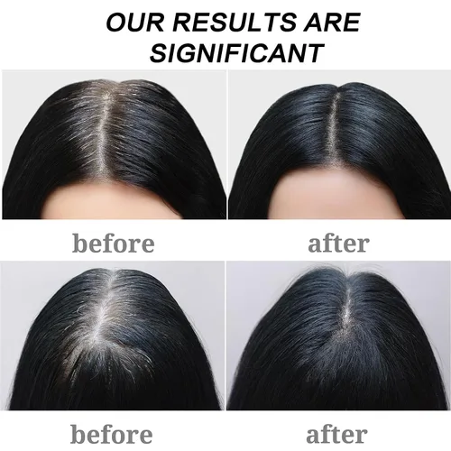 Vista 5 de Barra de champú reversible para cabello gris, 2 unidades de jabón para oscurecer el cabello gris para limpiar profundamente el cuero cabelludo