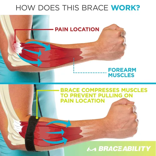 Vista 4 de BraceAbility Soporte para la epicóndilitis Correa de codo para dolor de epicóndilo medial/lateral y tendinitis banda de compresión de brazo