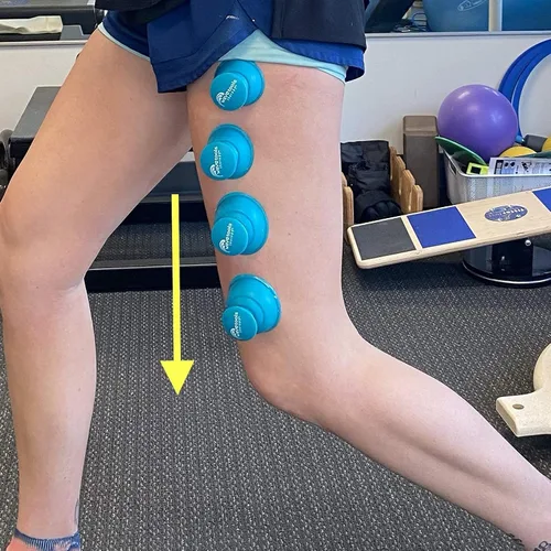 Vista 5 de Riptide" Sport Cupping juego de 4 copas de empuje en estuche de Wavetools Therapy ideal para ventosas dinámicas, dos ventosas fuertes