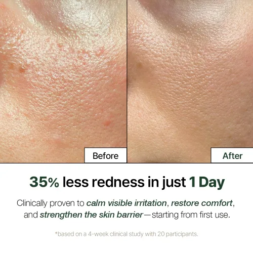 Vista 3 de NATURAL DERMA PROJECT NDP Cica Cream - Crema hidratante facial de gel para aliviar quemaduras solares, hidratante coreano ligero para pieles