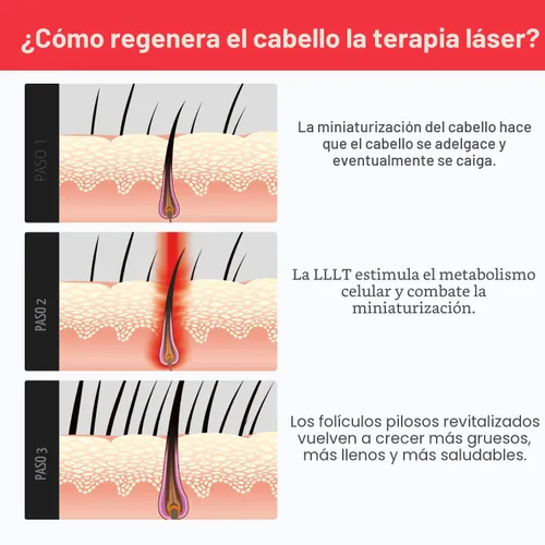 Vista 8 de iRestore Sistema de crecimiento del cabello con láser esencial: tratamientos de pérdida de cabello aprobados por la FDA para hombres y mujeres